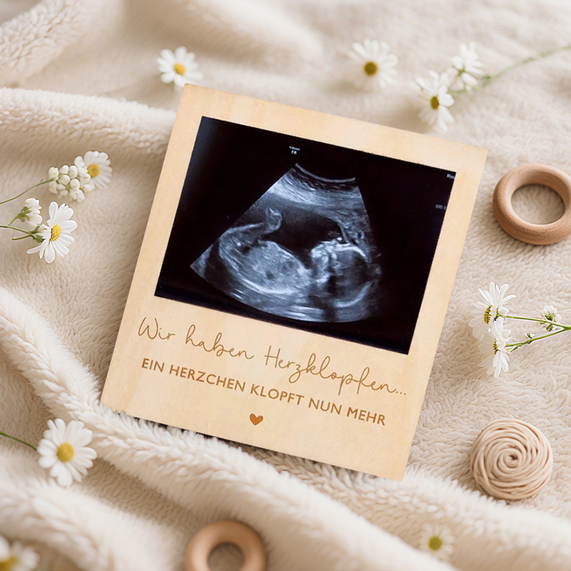 Ultrasound Pregnancy Announcem - Photo Booth Frame recension och pris