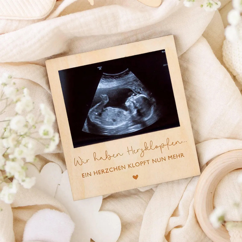 Ultrasound Pregnancy Announcem - Photo Booth Frame recension och pris